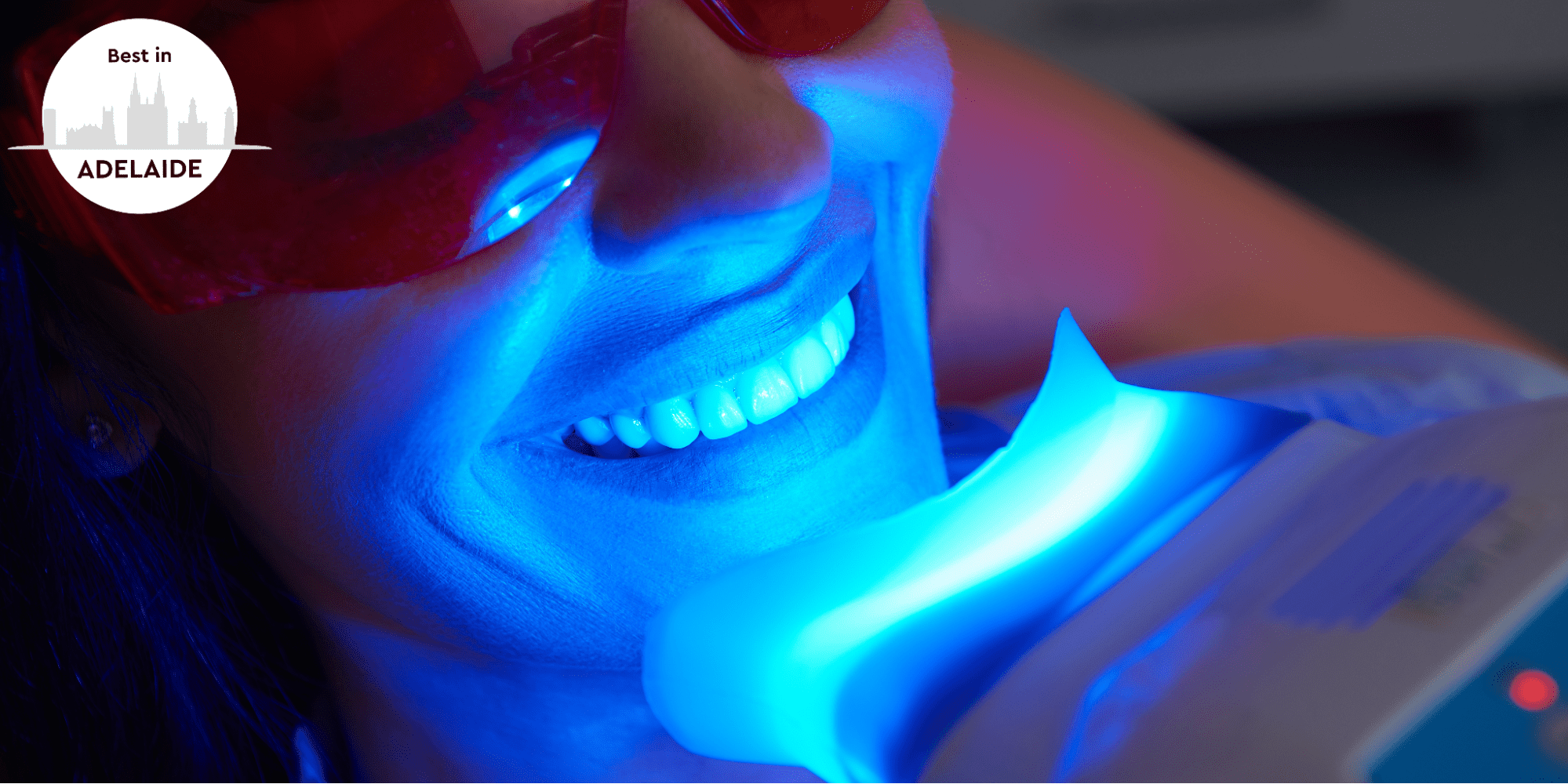 The 5 Best Teeth Whitening Services in Adelaide Homepage