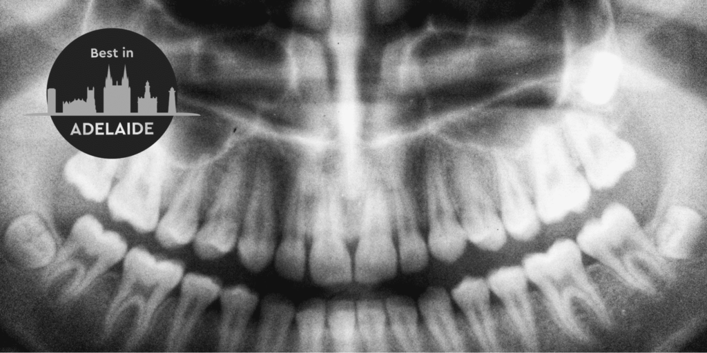 The 5 Best Cosmetic Dentistry Services in Adelaide Homepage