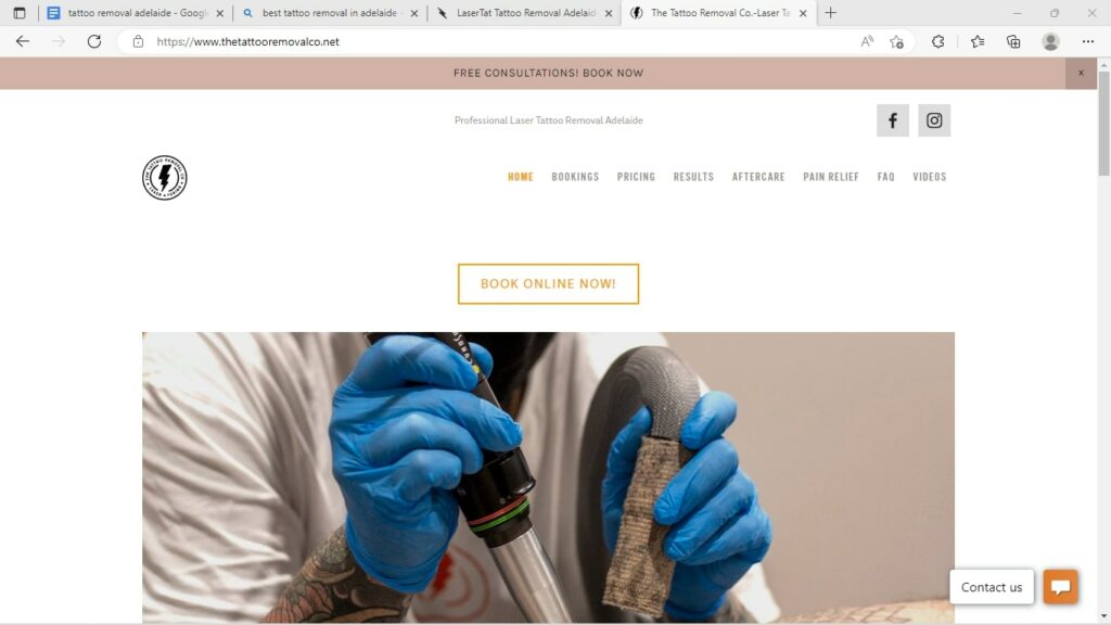 Tattoo Removal Co.' Homepage