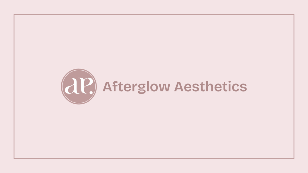 afterglow-aesthetics-logo